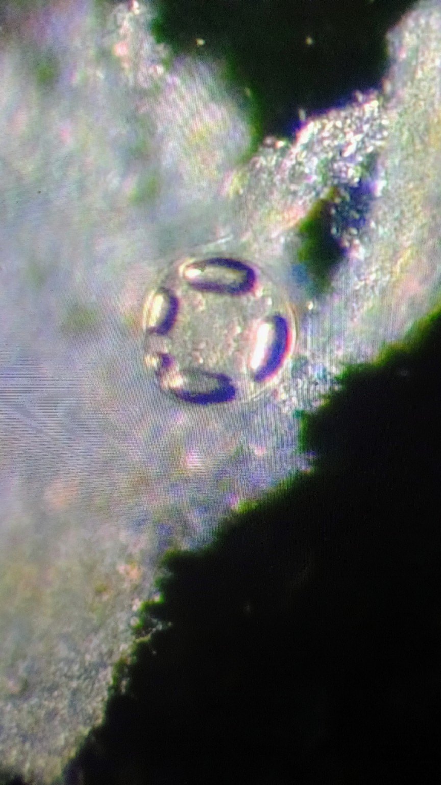 Microscope image showing a small droplet-like form and hidden textures